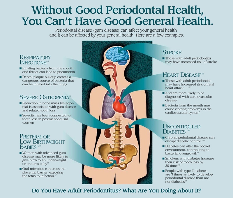 BEWARE !! “POOR ORAL HEALTH CAN AFFECT YOUR GENERAL HEALTH”