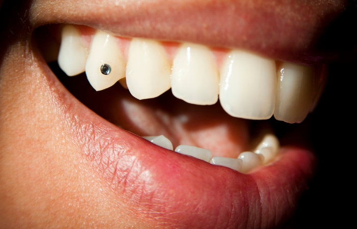ADD SPARKLES TO YOUR SMILE….. GET A TOOTH JEWEL…!!!