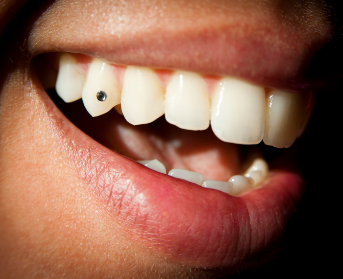 ADD SPARKLES TO YOUR SMILE….. GET A TOOTH JEWEL…!!!