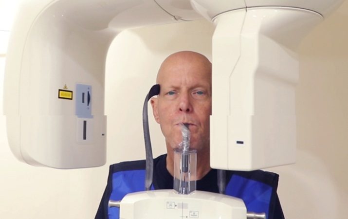 BENEFITS OF CBCT SCAN