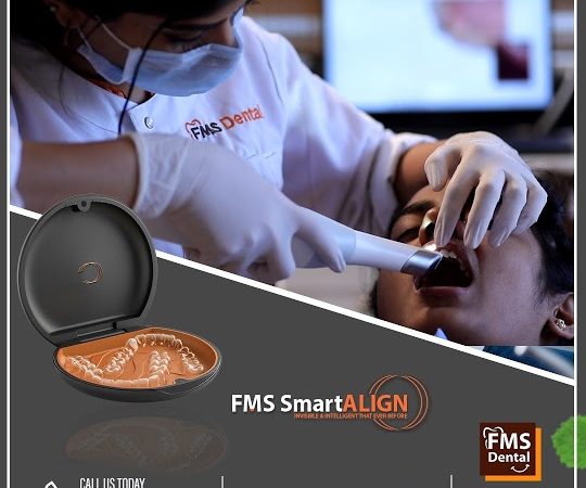 FMS SmartAlign