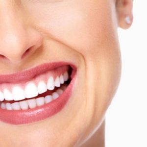 WHAT CAN BE DONE FOR GUMMY SMILE?