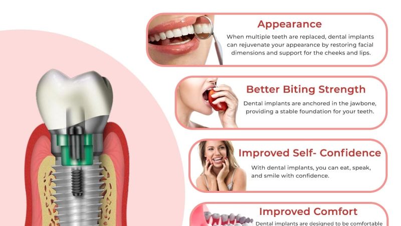 Exploring Different Types of Dental Implants: Choosing the Right One for You