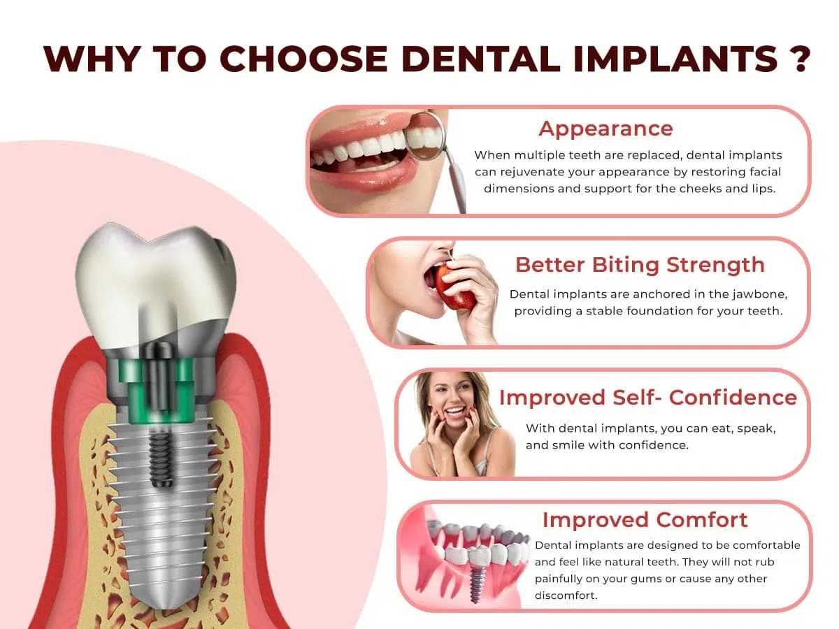 Exploring Different Types of Dental Implants: Choosing the Right One for You