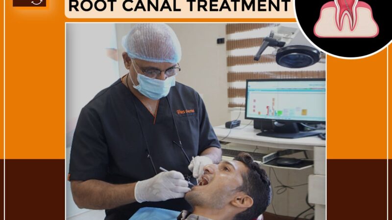 Why Do We Place a Crown After Root Canal Treatment? Is It Necessary?