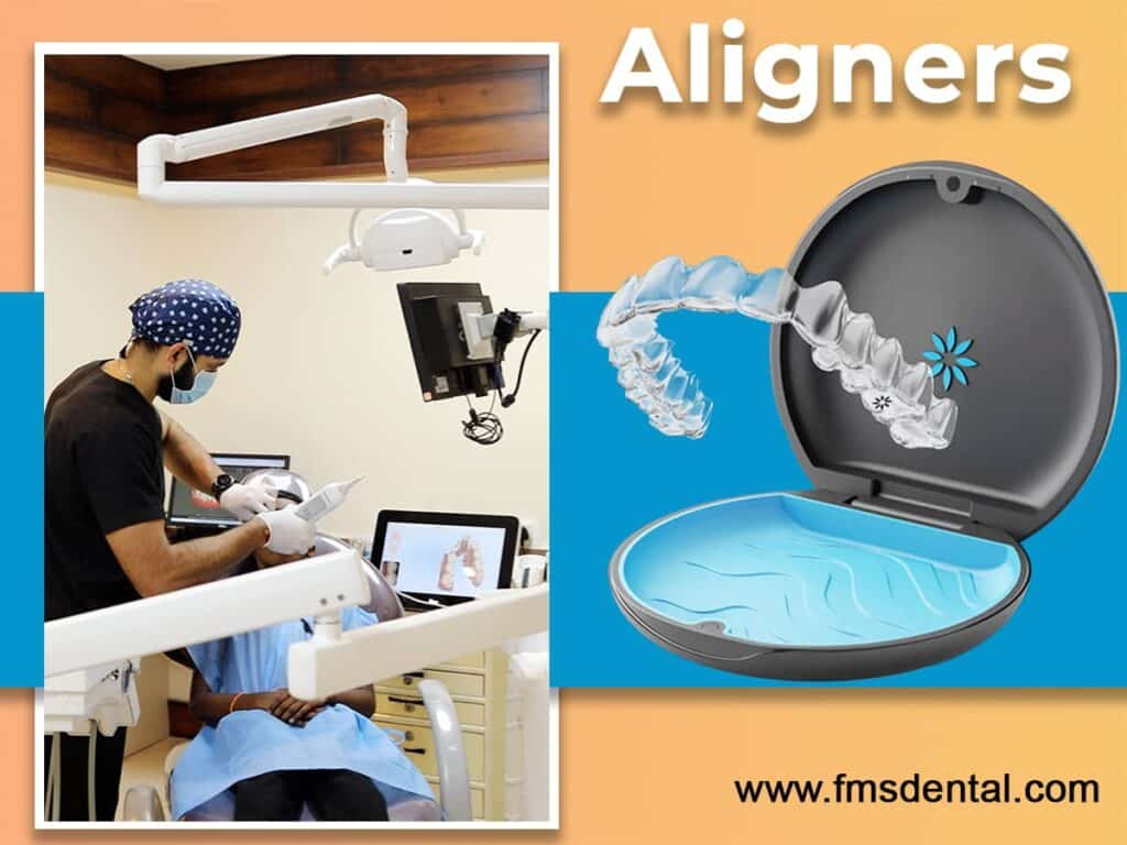 Smartalign Top Cosmetic Dental Procedures at FMS Dental Clinics