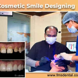 Top Cosmetic Dental Procedures at FMS Dental Clinics