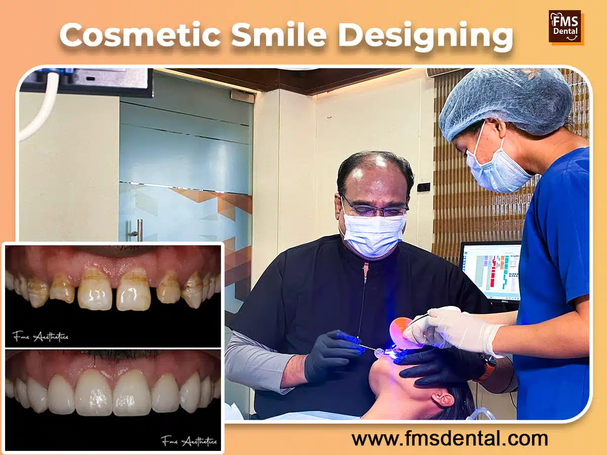 Top Cosmetic Dental Procedures at FMS Dental Clinics