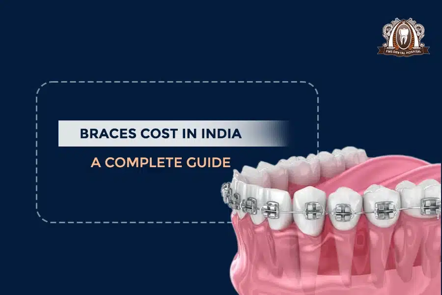 braces cost