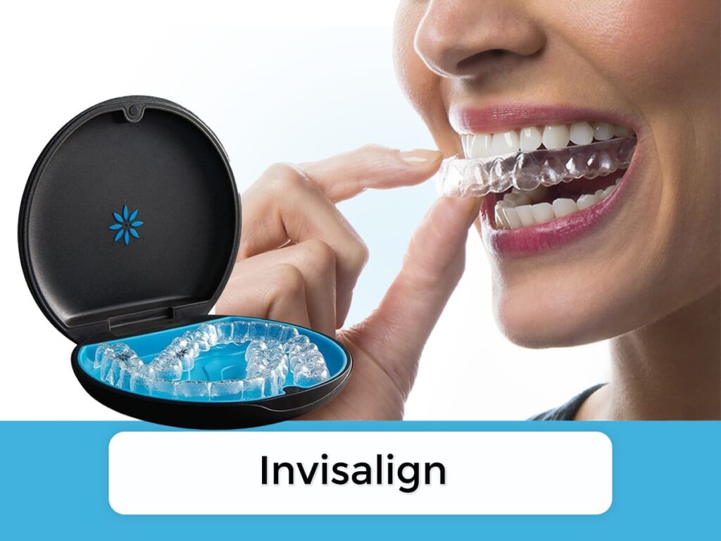 invisalign