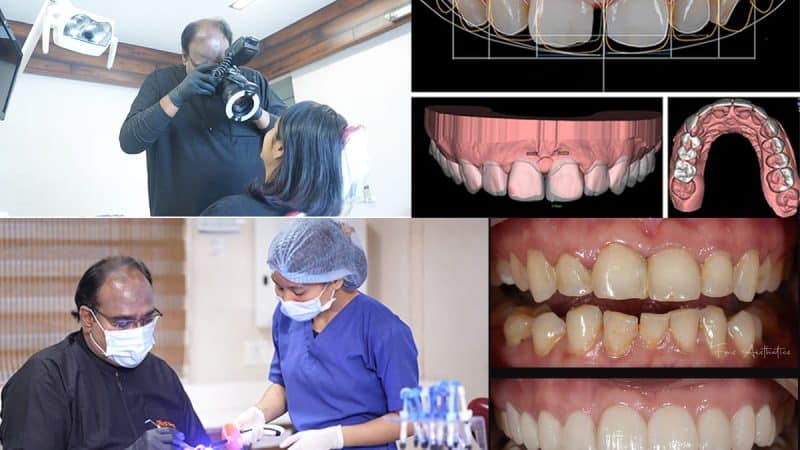 Is better communication of smile possible now a days with Cosmetic Dentistry Softwares?