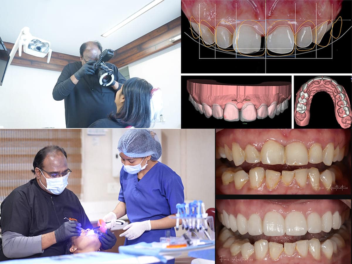 Is better communication of smile possible now a days with Cosmetic Dentistry Softwares?