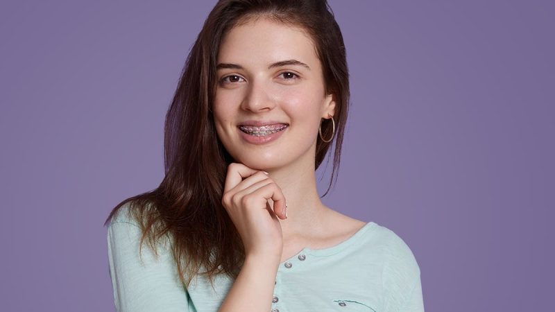 How did Aligners (Invisalign) evolve from Braces