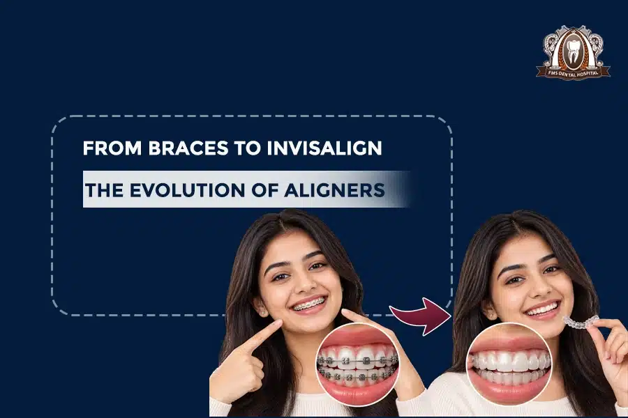 braces to invisalign