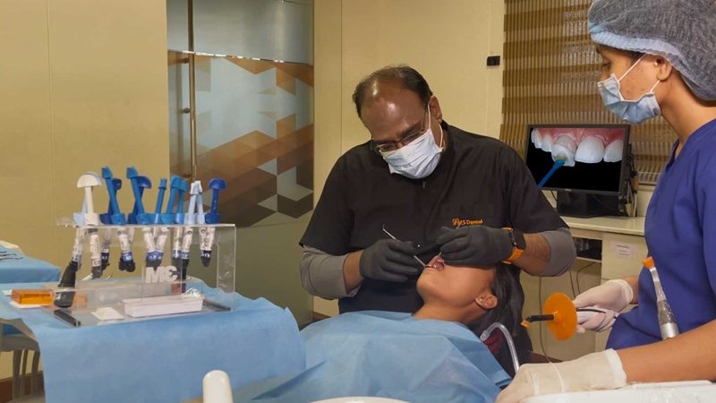 Dental Veneers vs. Bonding:  Which Cosmetic Fix Is Right for Your Smile?