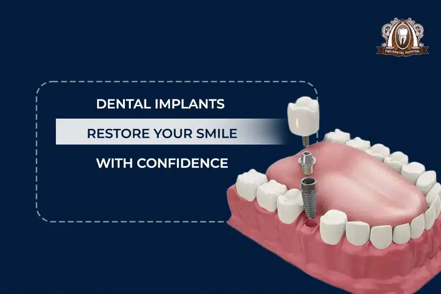 implants