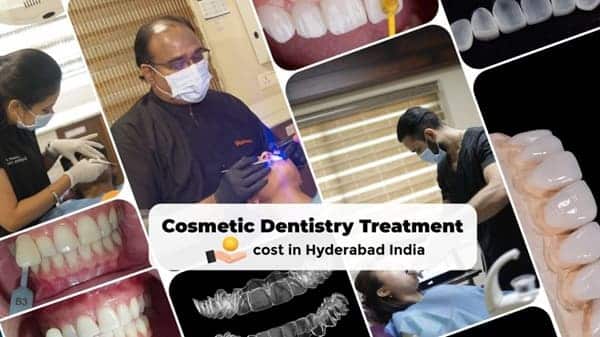 Cosmetic Dentistry Treatment Cost in Hyderabad, India – FMS Dental