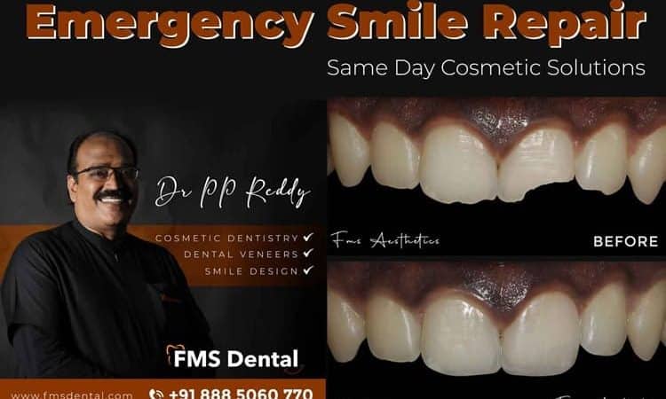 Emergency Smile Repair: Same Day Cosmetic Solutions