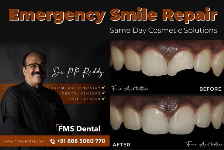 Emergency Smile Repair: Same Day Cosmetic Solutions