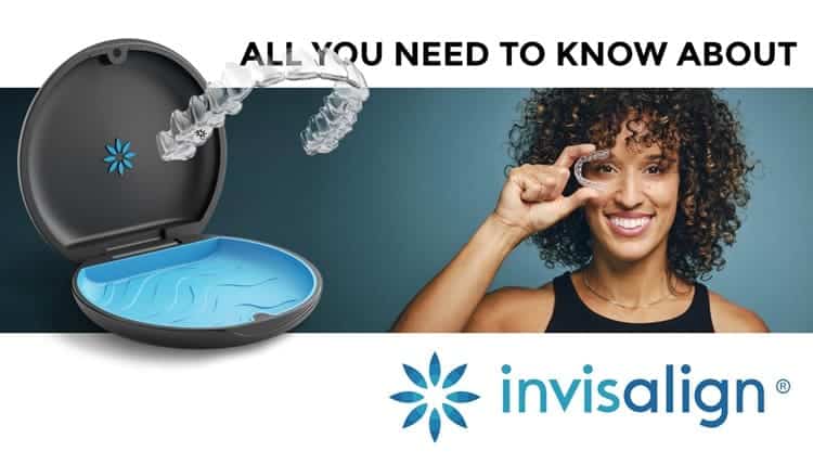 Everything You Need to Know About Invisalign Treatment – Step By Step Guide