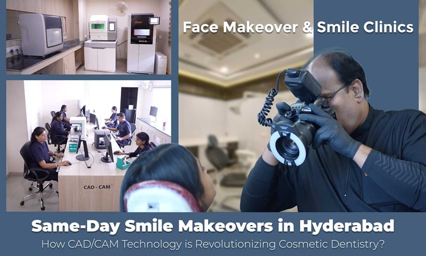 Same-Day Smile Makeovers in Hyderabad: How CAD/CAM Technology is Revolutionizing Cosmetic Dentistry.