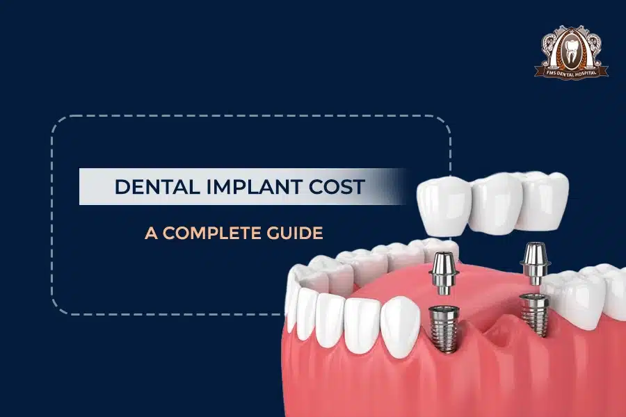 dental implant cost