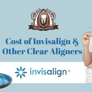 Cost of Invisalign and Other Clear Aligners