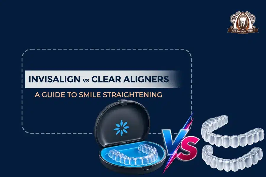 invisalign & clear aligners