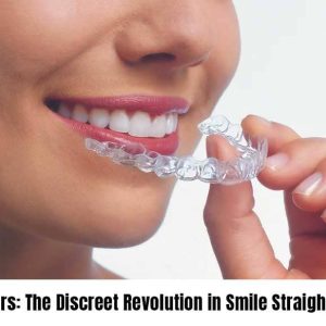 Invisalign and Other Clear Aligners: The Discreet Revolution in Smile Straightening