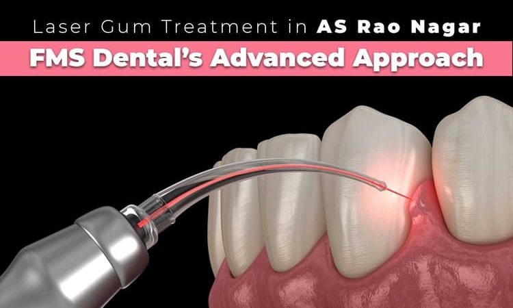 Laser Gum Treatment in A S Rao Nagar – FMS Dental’s Advanced Approach