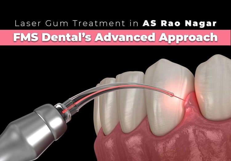 Laser Gum Treatment in A S Rao Nagar – FMS Dental’s Advanced Approach
