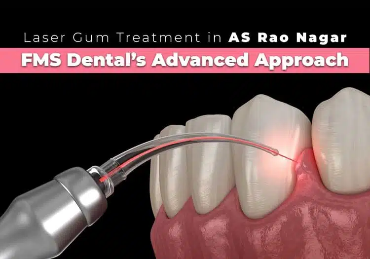Laser Gum Treatment in A S Rao Nagar – FMS Dental’s Advanced Approach