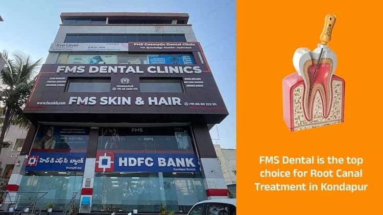 Why FMS Dental is the Top Choice for Root Canal Treatment in Kondapur