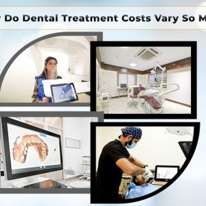 Why Do Dental Treatment Costs Vary So Much? Understanding What Truly Impacts the Price of Your Smile