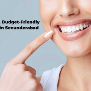 Where I can get Budget-Friendly Smile Design in Secunderabad