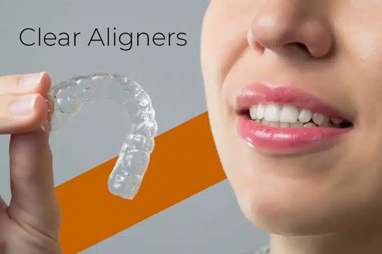 Trusted Clear Aligner Treatment in A S Rao Nagar