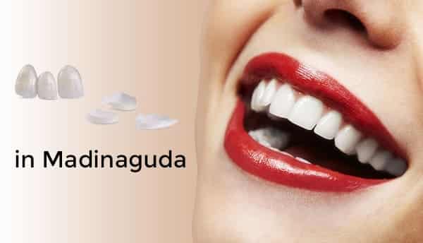 Cosmetic Dental Treatments in and around Madinaguda