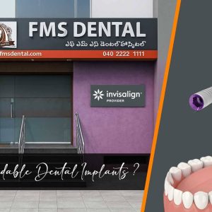 Are Affordable Dental Implants available at FMS Dental Secunderabad?