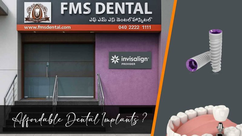 Are Affordable Dental Implants available at FMS Dental Secunderabad?
