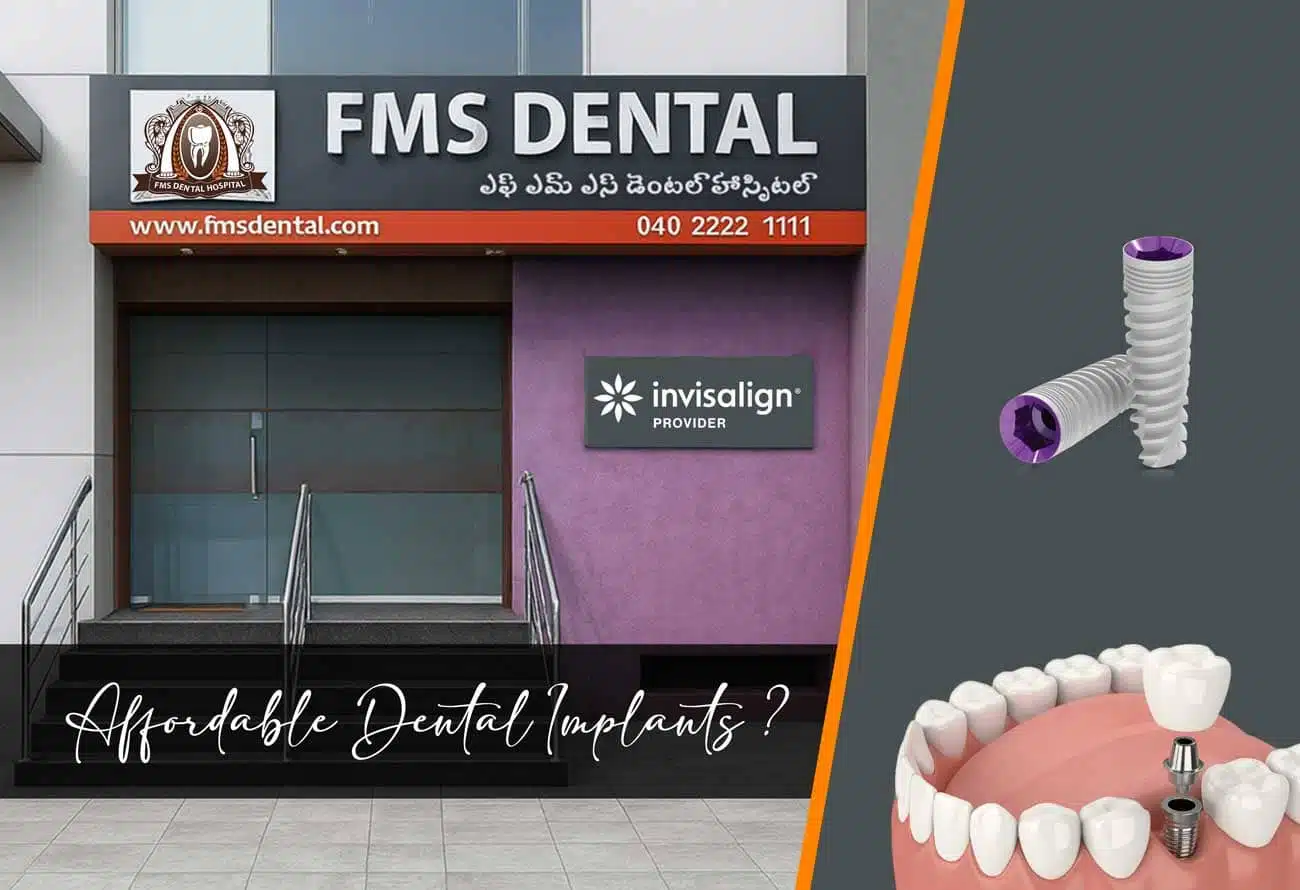 Are Affordable Dental Implants available at FMS Dental Secunderabad?