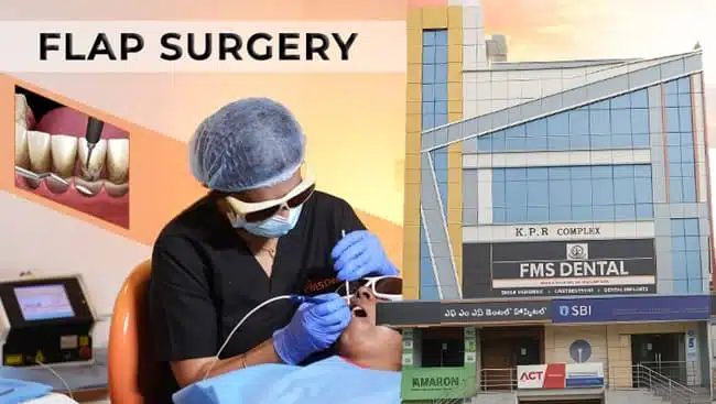Which Dental Clinic in Kukatpally is Best for Flap Surgery?