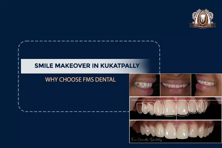 smile makeover