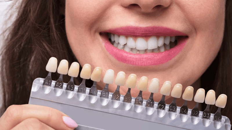 Expert Teeth Whitening Treatment in Dilsukhnagar