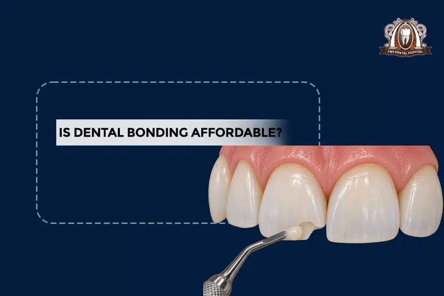 DENTAL BONDING