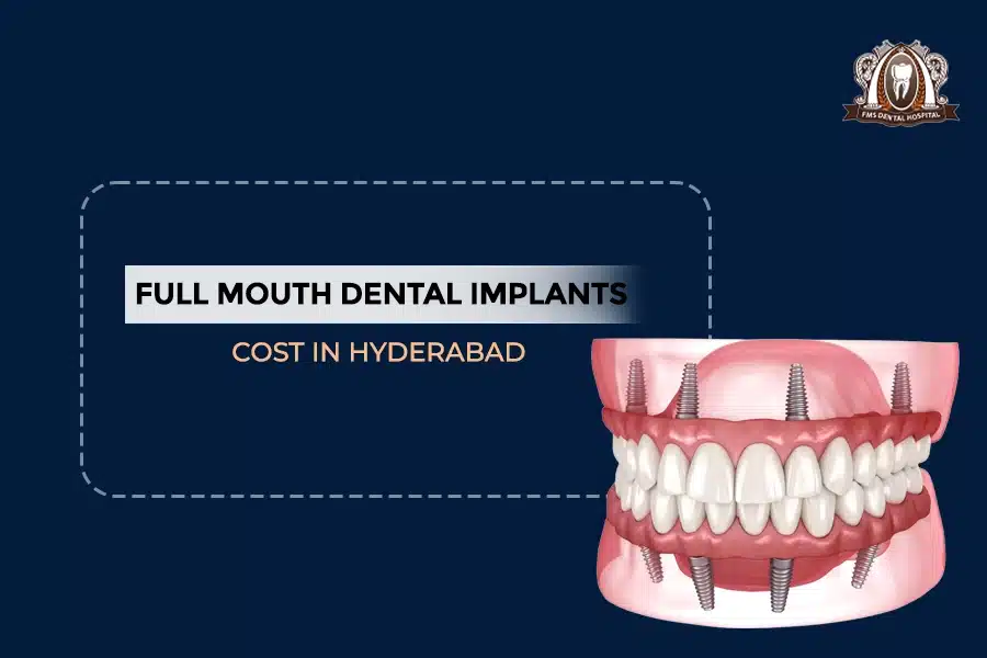 FULLMOUTH