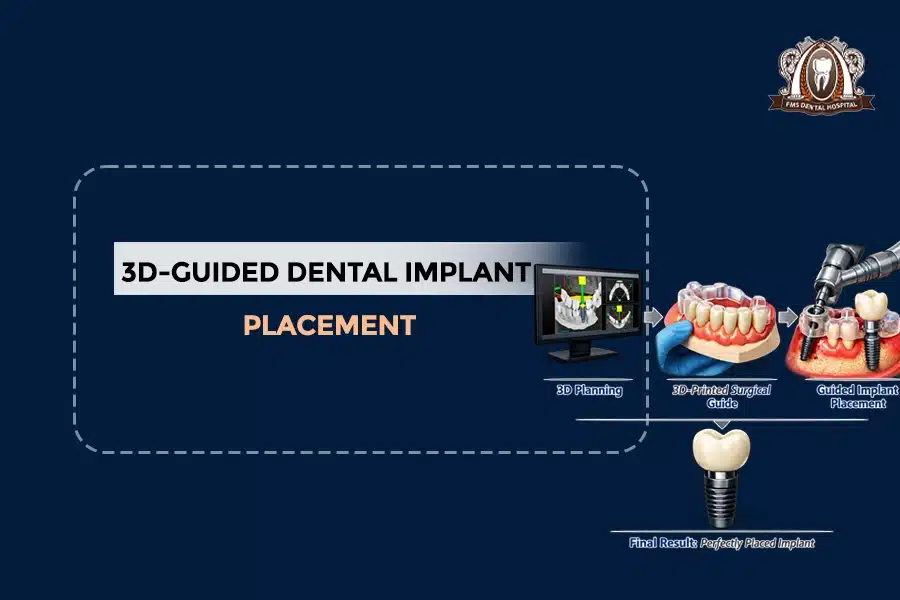 3d guided