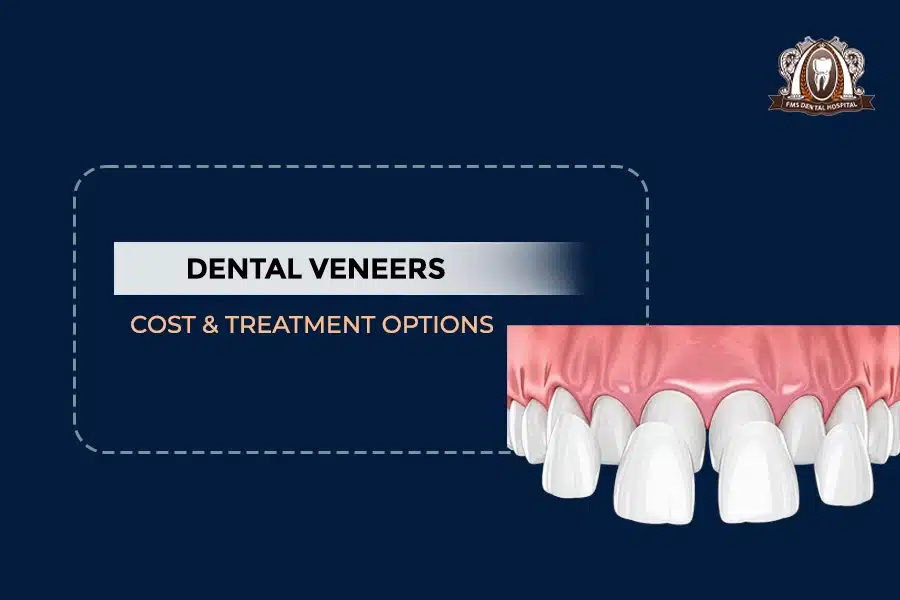 DENTAL VEENERS
