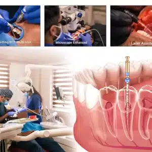 ROOT CANAL TREATMENT IN INDIA: A COMPLETE COST GUIDE FOR 2026