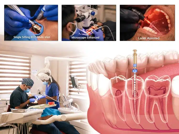 ROOT CANAL TREATMENT IN INDIA: A COMPLETE COST GUIDE FOR 2026