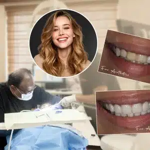 Smile Makeover Cost in Hyderabad, India